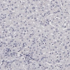 Immunohistochemical staining of human liver shows no positivity in hepatocytes as expected.
