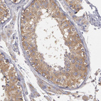 Anti-NEK9 Antibody