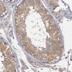 Immunohistochemical staining of human testis shows moderate cytoplasmic positivity in cells in seminiferous ducts.