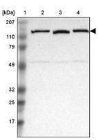 Lane 1: Marker [kDa] 207, 110, 79, 49, 32, 25, 17_br/_Lane 2: Human cell line RT-4_br/_Lane 3: Human cell line EFO-21_br/_Lane 4: Human cell line A-431