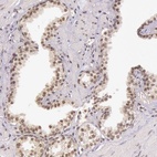 Anti-C22orf29 Antibody