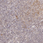 Immunohistochemical staining of human tonsil shows strong granular cytoplasmic positivity in non-germinal center cells.