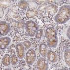 Immunohistochemical staining of human gastrointestinal shows strong granular cytoplasmic positivity in glandular cells.