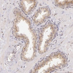 Immunohistochemical staining of human prostate shows strong granular cytoplasmic positivity in glandular cells.