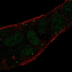 Immunofluorescent staining of human cell line RT4 shows localization to nucleoplasm & vesicles.