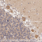 Anti-ATG2B Antibody