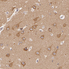 Anti-ATG2B Antibody