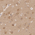 Immunohistochemical staining of human Cerebral cortex shows moderate cytoplasmic positivity in neuronal cells.