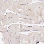 Anti-ATG2B Antibody