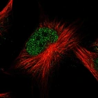 Immunofluorescent staining of human cell line U-251 MG shows localization to nucleoplasm.