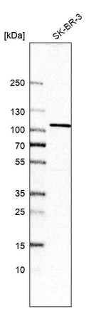 Western blot analysis in human cell line SK-BR-3.