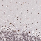 Anti-C6orf15 Antibody