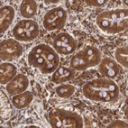 Anti-ASCC2 Antibody