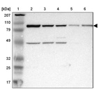 Lane 1: Marker [kDa] 207, 110, 79, 49, 32, 25, 17_br/_Lane 2: Human cell line RT-4_br/_Lane 3: Human cell line EFO-21_br/_Lane 4: Human cell line A-431_br/_Lane 5: Human liver tissue_br/_Lane 6: Human tonsil tissue