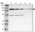 Anti-ASCC2 Antibody