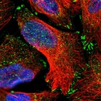 Immunofluorescent staining of human cell line U-2 OS shows localization to nucleus, cytosol & focal adhesion sites.