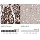 Anti-VSIG1 Antibody