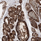 Immunohistochemical staining of human stomach shows high expression.