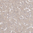 Immunohistochemical staining of human liver shows low expression as expected.