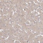 Anti-VSIG1 Antibody