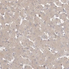 Immunohistochemical staining of human liver shows low expression as expected.