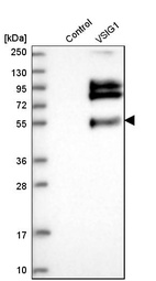 Western blot analysis in control (vector only transfected HEK293T lysate) and vSIG1 over-expression lysate (Co-expressed with a C-terminal myc-DDK tag (~3.1 kDa) in mammalian HEK293T cells, LY403639).