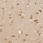 Immunohistochemical staining of human hippocampus shows moderate granular positivity in cytoplasm in neurons.