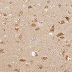 Immunohistochemical staining of human hippocampus shows moderate granular positivity in cytoplasm in neurons.