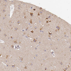 Immunohistochemical staining of human cerebral cortex shows moderate granular positivity in cytoplasm in neurons.