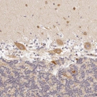 Immunohistochemical staining of human cerebellum shows moderate granular positivity in cytoplasm in Purkinje cells.