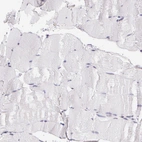 Immunohistochemical staining of human skeletal muscle shows no positivity in myocytes as expected.