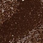 Immunohistochemical staining of human tonsil shows very strong cytoplasmic membranous positivity in non-germinal center cells and germinal center cells.
