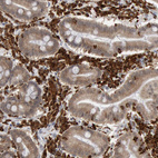 Anti-PTPN6 Antibody