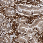 Immunohistochemical staining of human duodenum shows strong cytoplasmic positivity in lymphoid cells.