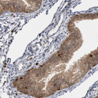 Anti-PTPN6 Antibody