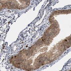 Immunohistochemical staining of human fallopian tube shows moderate cytoplasmic positivity in glandular cells.