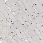 Immunohistochemical staining of human skeletal muscle shows negative cytoplasmic positivity in myocytes as expected.