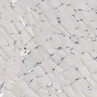Immunohistochemical staining of human skeletal muscle shows negative cytoplasmic positivity in myocytes as expected.
