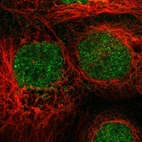 Immunofluorescent staining of human cell line A-431 shows localization to nucleus.