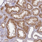 Immunohistochemical staining of human kidney shows strong membranous positivity in cells in tubules.