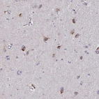 Immunohistochemical staining of human cerebral cortex shows moderate cytoplasmic positivity in neurons.