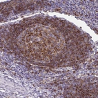 Immunohistochemical staining of human lymph node shows strong membranous positivity in germinal center cells.