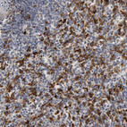 Anti-C1QC Antibody