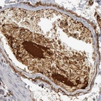 Immunohistochemical staining of human small intestine shows strong positivity in plasma.