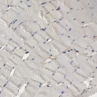Immunohistochemical staining of human skeletal muscle shows no positivity in myocytes as expected.