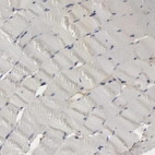 Immunohistochemical staining of human skeletal muscle shows no positivity in myocytes as expected.