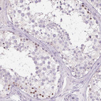 Anti-CTCFL Antibody