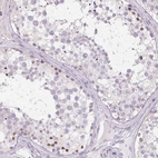 Immunohistochemical staining of human testis shows moderate nuclear positivity in cells in seminiferous ducts.