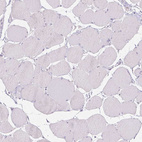 Anti-CTCFL Antibody