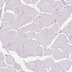 Immunohistochemical staining of human skeletal muscle shows no positivity in myocytes as expected.